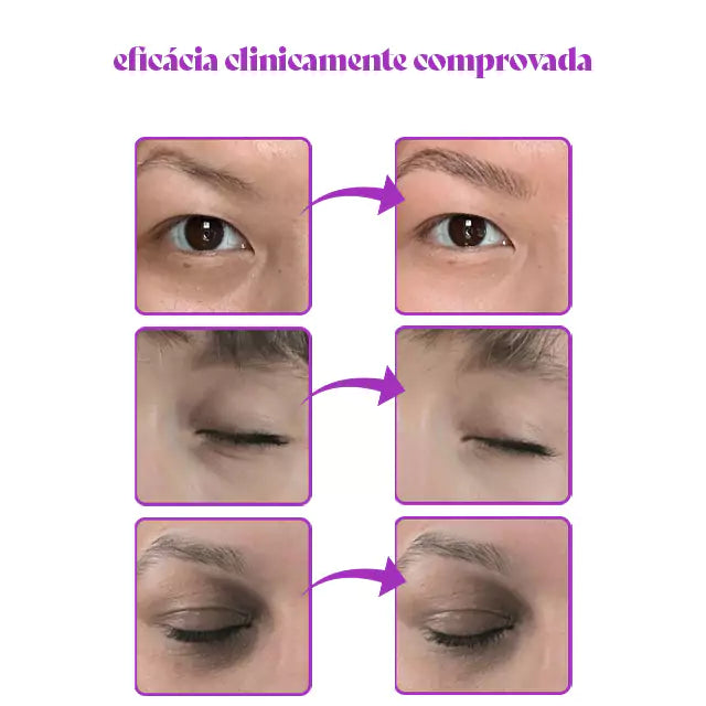 Luminous - Corrector de ojeras que revitaliza e ilumina el contorno de los ojos